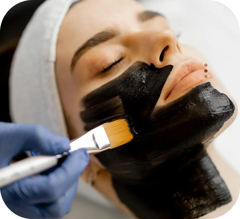 An activated charcoal mask being applied during a Hollywood Peel facial
