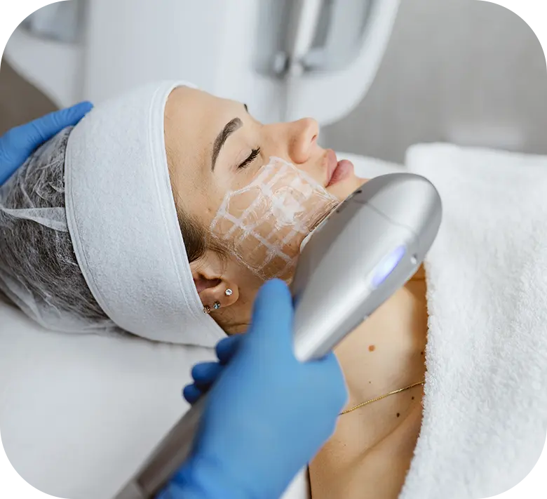 A focused-ultrasound Ultraformer treatment being performed on the face